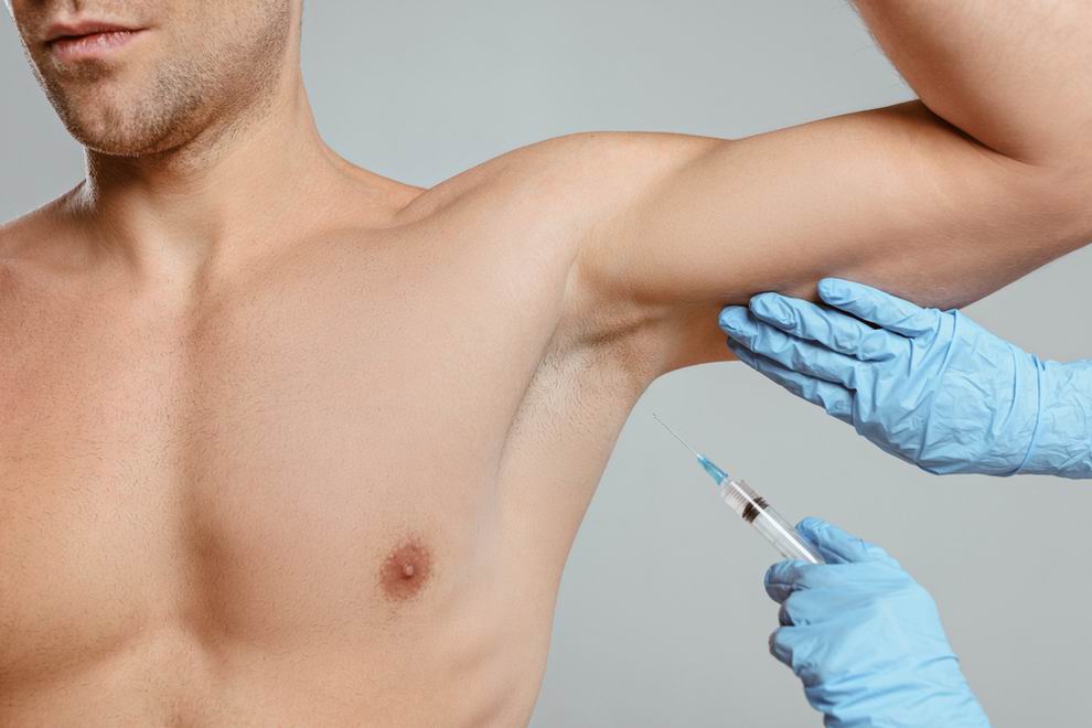 botox férfiaknak